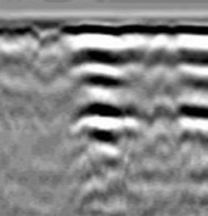 コンクリート背面の空洞による反応例